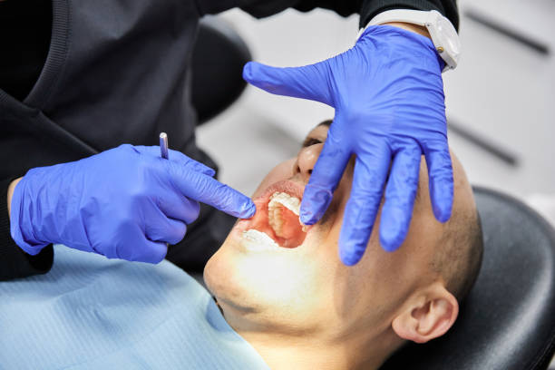 Best Emergency Dental Care for Broken or Chipped Teeth in Stonybrook, PA