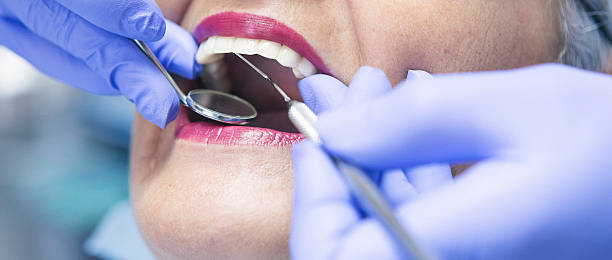 Best Emergency Treatment for Dental Infections or Abscesses in Stonybrook, PA